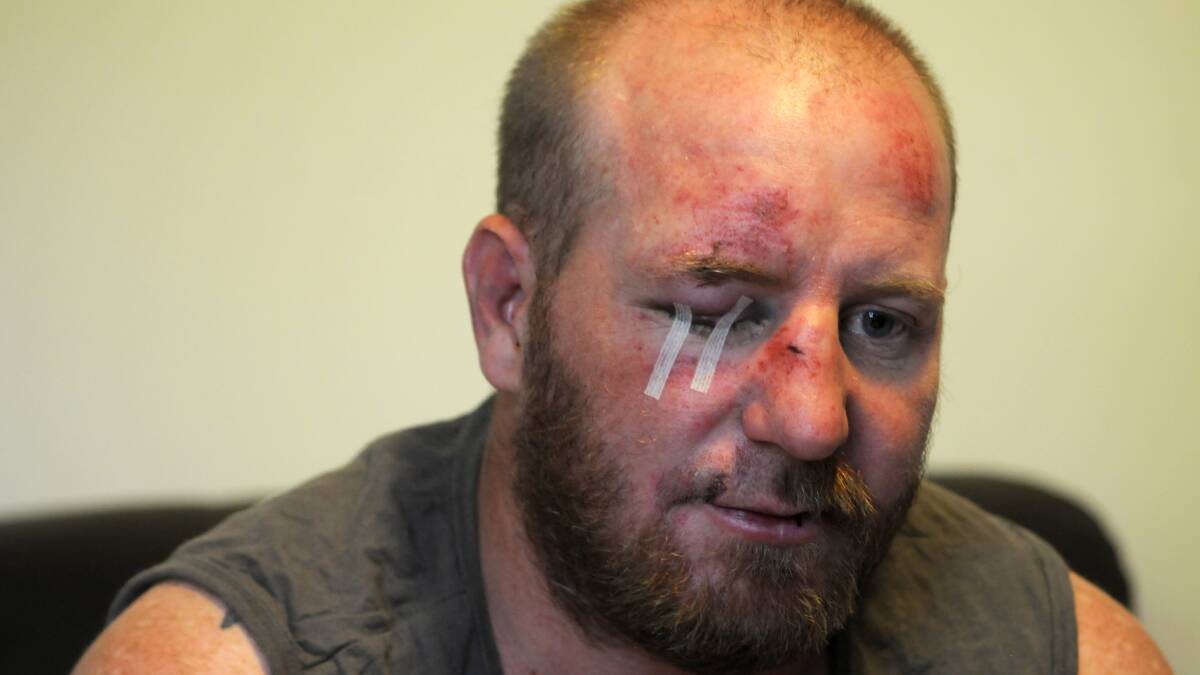 GROUP ATTACK: Benjamin Thompson says he was attacked by a group of people after making a noise complaint. Photo: STEVE GOSCH                                                                          0208sgbash4
