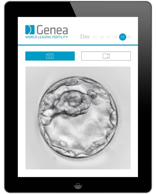 DAY 5: An embryo is seen in its fifth day on a tablet in this image. Photo: Supplied