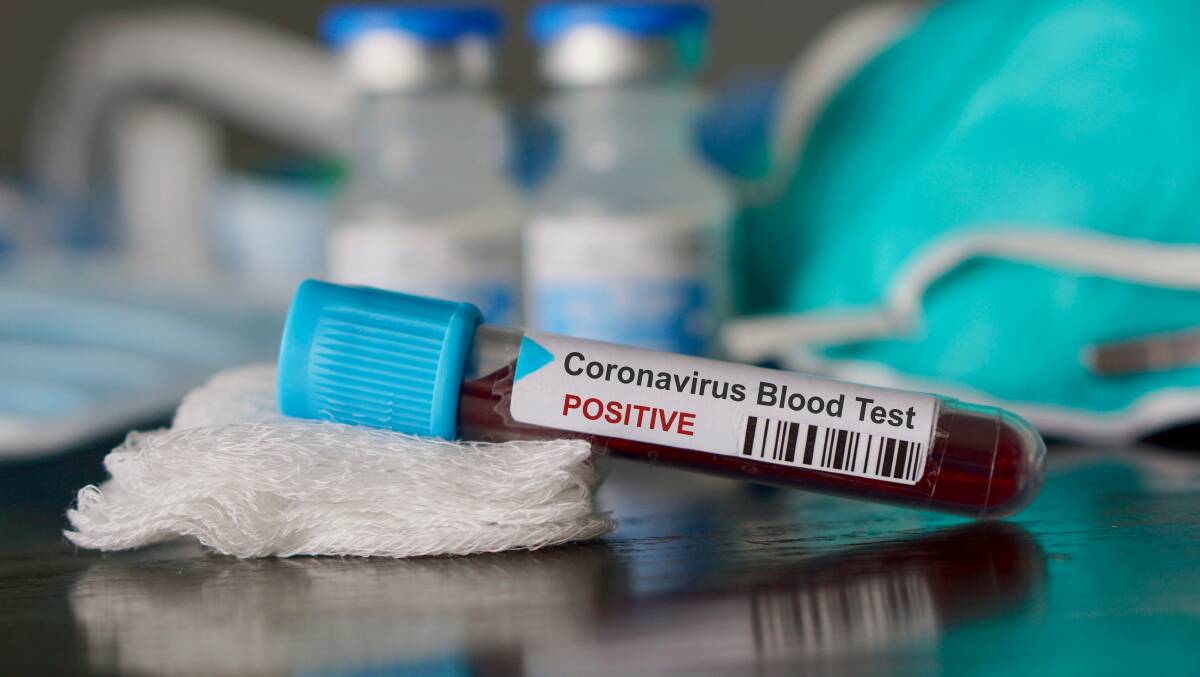 NEW CASES: There are three confirmed cases of COVID-19 in the Dubbo electorate. Photo: SHUTTERSTOCK