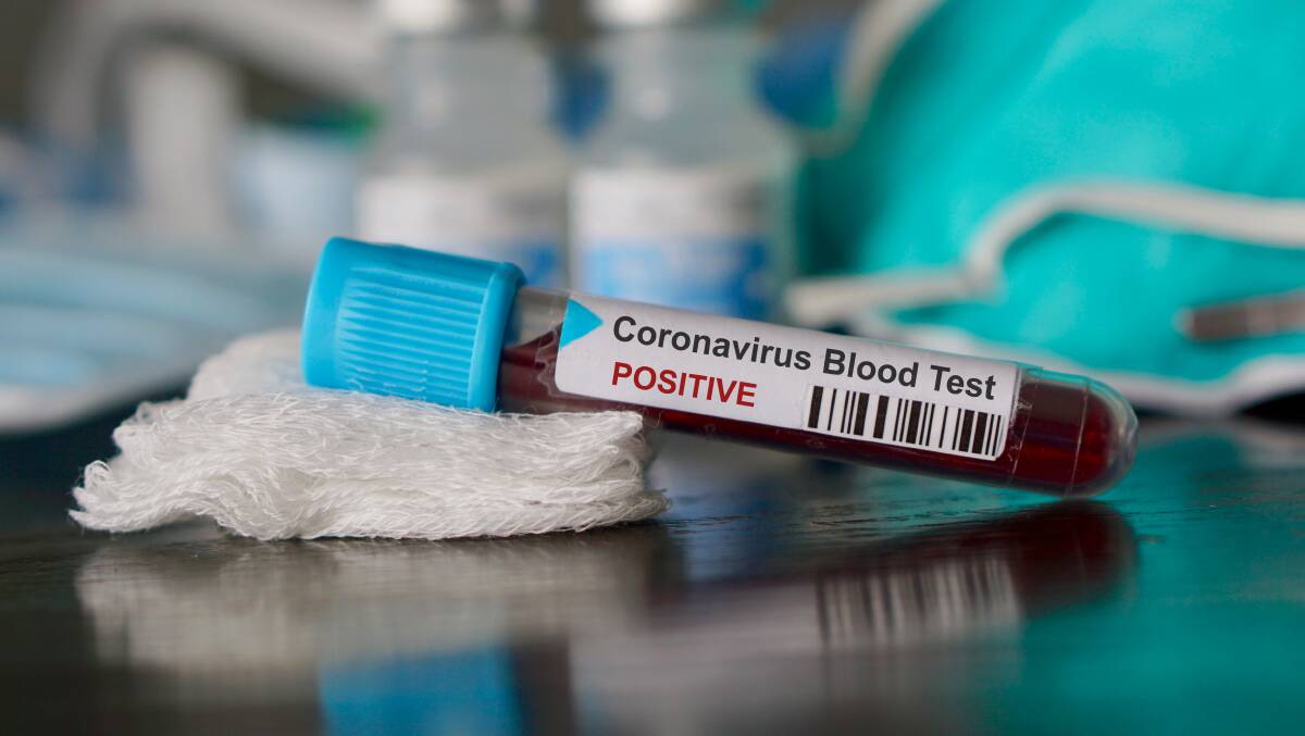 Orange gains one more coronavirus case as Western total rises to 38