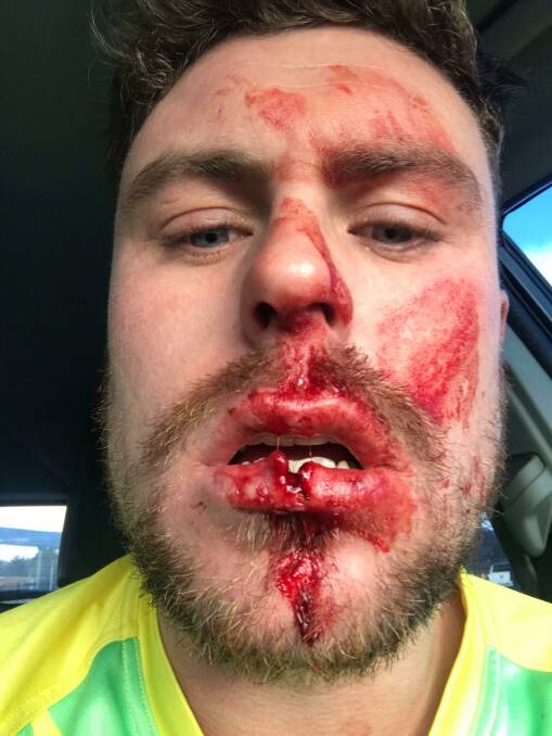 COP THAT: Robbie Mortimer is out this week for CYMS after coming away from Lithgow last week looking worse for ware. Photo: CONTRIBUTED