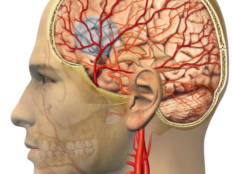 Research shows the brain has a two-week opportunity to more easily repair itself after stroke.