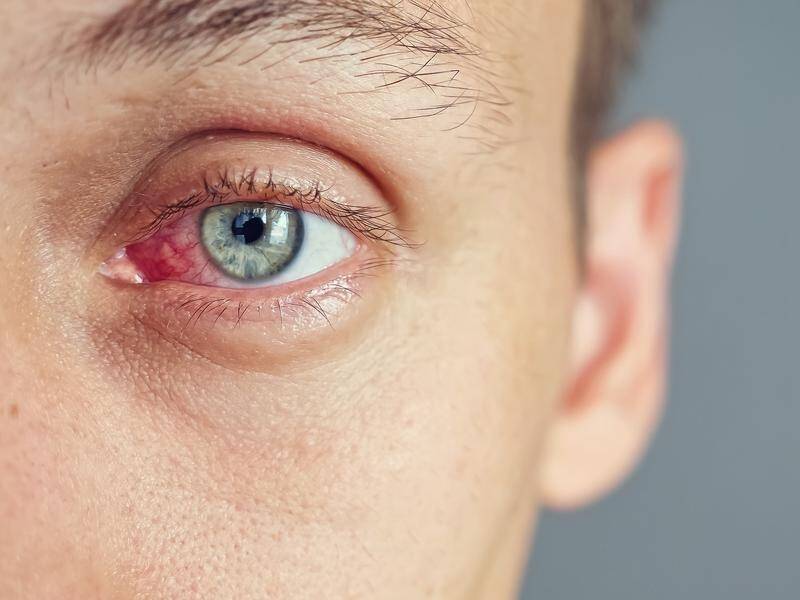 Puffy Eyes: Symptoms, Causes And Remedies – Forbes Health