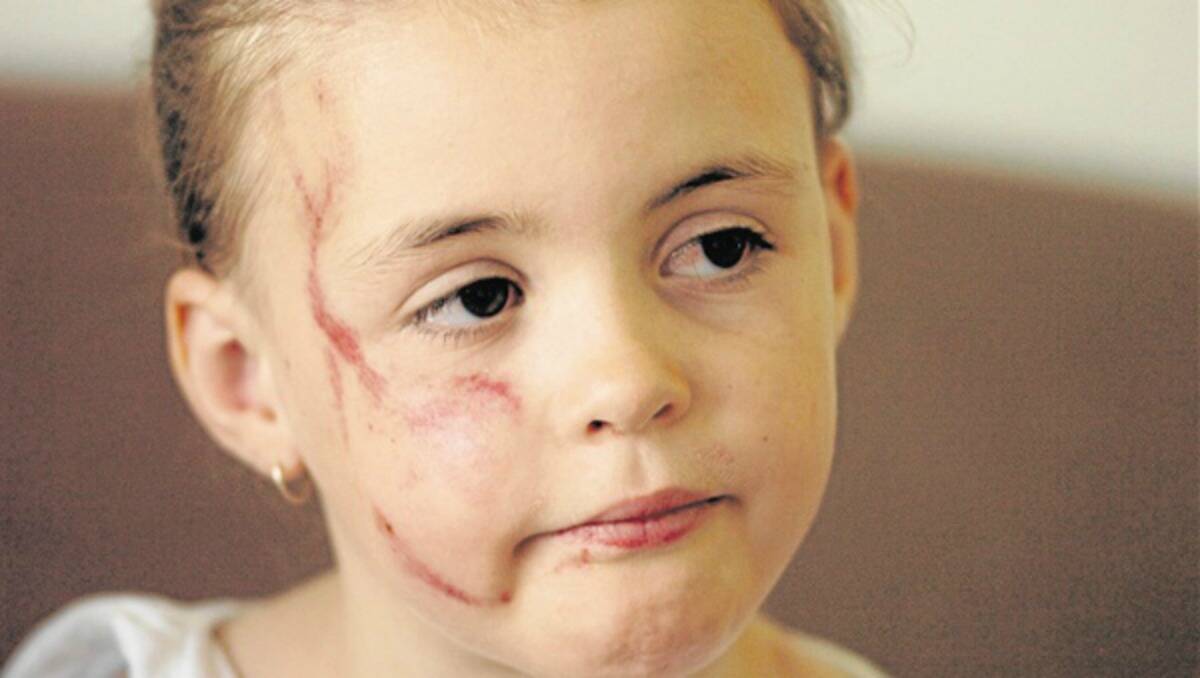 BATTERED AND BRUISED: Seven-year-old Orange girl Makayla McEvoy was lucky to be alive following a kangaroo attack on New Year’s Day. Inset: Makayla’s bruised and heavily grazed back. Photos: STEVE GOSCH       0102sgroo2 and 3
